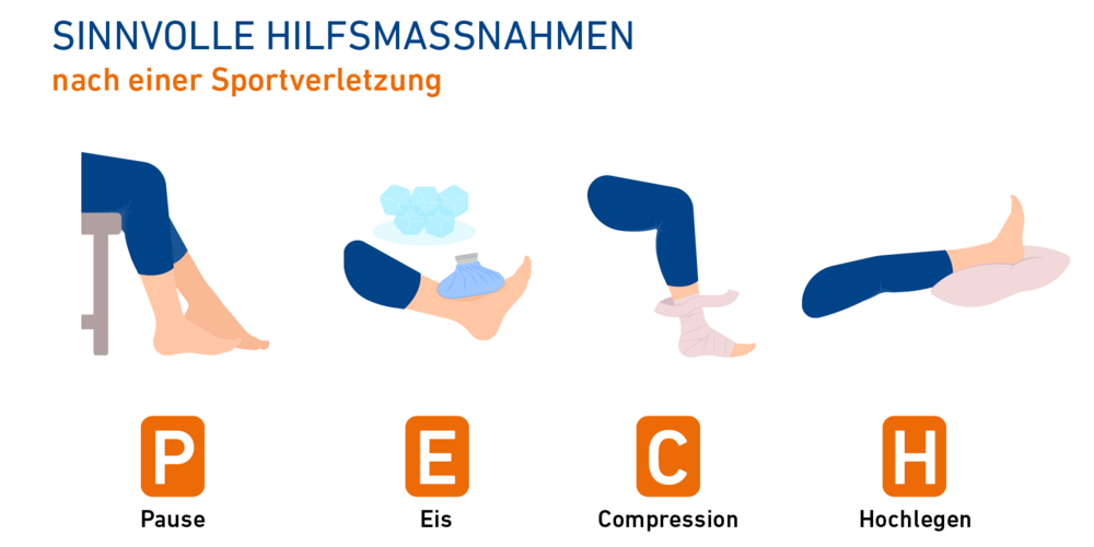 Die Grafik stellt die vier Schritte der PECH-Regel dar, mit der eine Verstauchung therapiert werden kann.